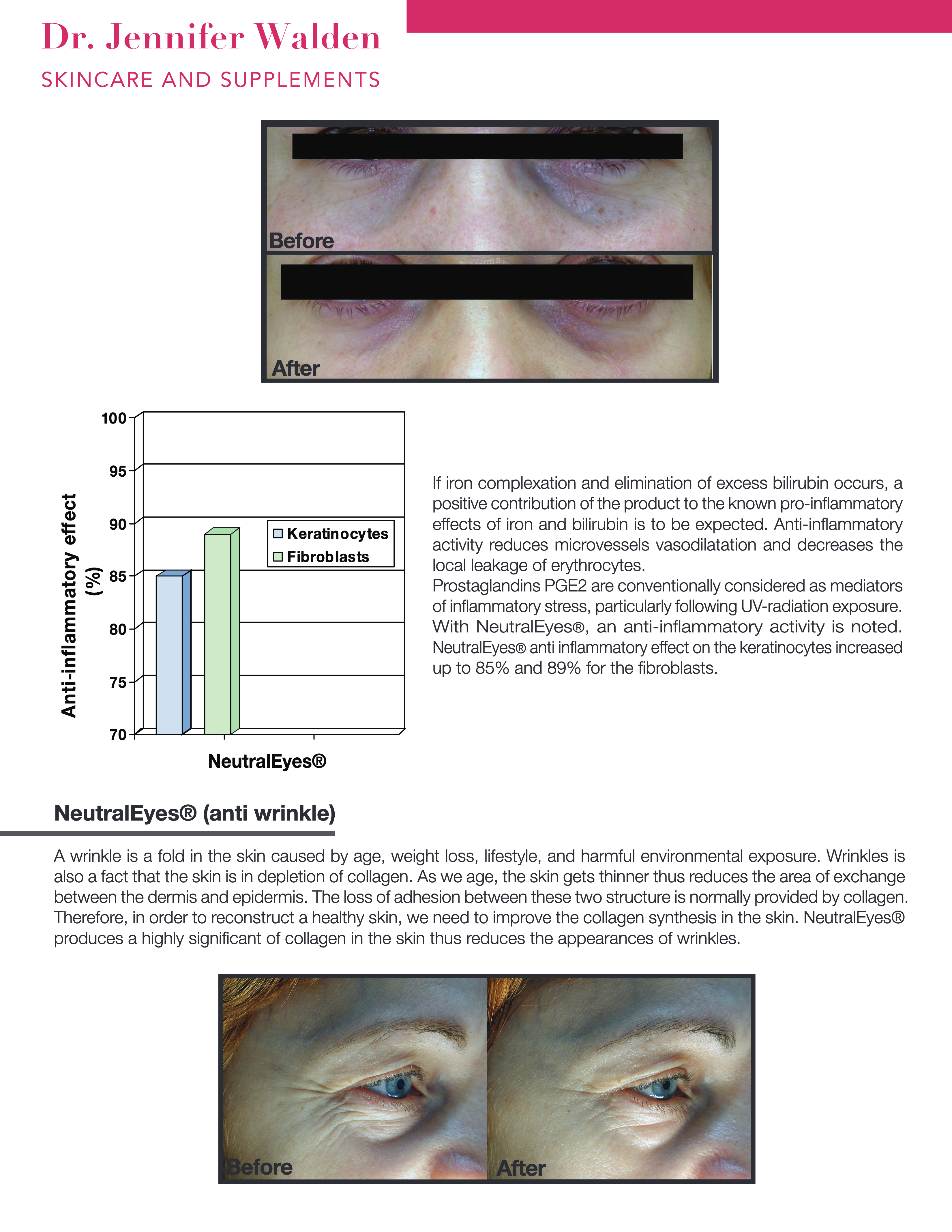 NEUTRALEYES+ EYE COMPLEX-4