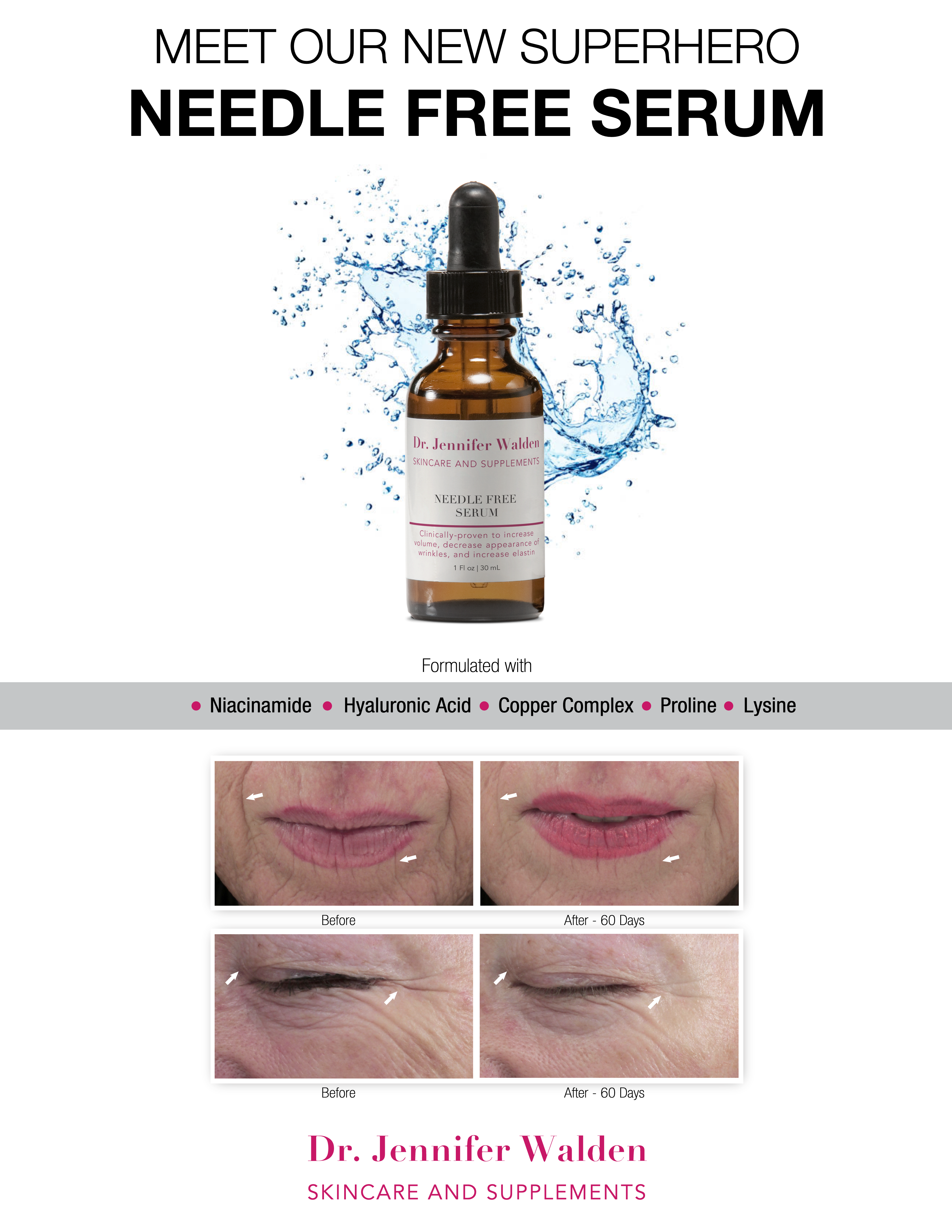 NEEDLE FREE SERUM-4